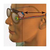 eye implant